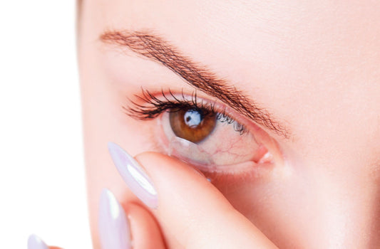 my contacts give me dry eyes