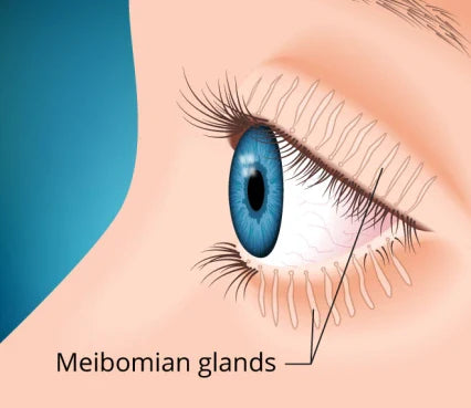 Understanding Meibomian Gland Dysfunction (MGD): The Root of Many Dry Eye Cases